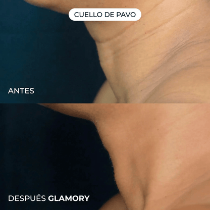Luce una piel más firme y  joven. Sin necesidad de inyecciones.